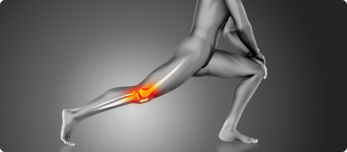 Artificial Joint Coating